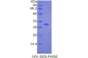 SDS-PAGE analysis of Mouse Fibulin 4 Protein. (FBLN4 Protein)