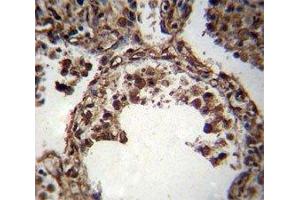 TUBA1C antibody immunohistochemistry analysis in formalin fixed and paraffin embedded human lung tissue. (TUBA1C antibody  (AA 414-441))