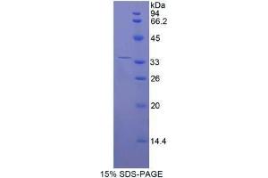 SDS-PAGE (SDS) image for Ectonucleotide Pyrophosphatase/phosphodiesterase 2 (ENPP2) (AA 637-905) protein (His tag) (ABIN2124695) (ENPP2 Protein (AA 637-905) (His tag))