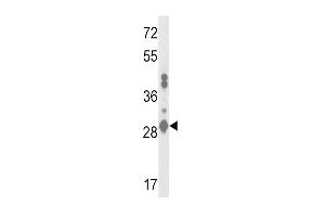 Western blot analysis of GSTA2 Antibody (N-term) (ABIN653362 and ABIN2842838) in MDA-M cell line lysates (35 μg/lane). (GSTa2 antibody  (N-Term))