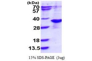 SDS-PAGE (SDS) image for ARD1 Homolog, N-Acetyltransferase (ARD1A) (AA 1-235) protein (His tag) (ABIN667945) (NAA10 Protein (AA 1-235) (His tag))