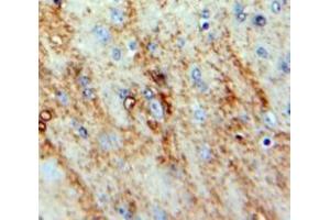 #VALUE! (NMS antibody  (AA 31-153))