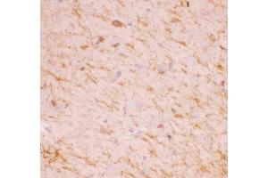 Immunohistochemistry (IHC) image for anti-Sirtuin 2 (SIRT2) (AA 165-187), (Middle Region) antibody (ABIN3043924)