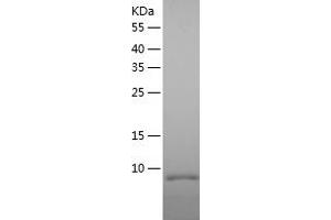 Western Blotting (WB) image for ethanolaminephosphotransferase 1 (CDP-Ethanolamine-Specific) (EPT1) (AA 1-26) protein (His tag) (ABIN7122822) (EPT1 Protein (AA 1-26) (His tag))