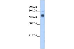 WB Suggested Anti-GCNT3 Antibody Titration:  1. (GCNT3 antibody  (C-Term))