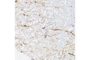 Immunohistochemistry of paraffin-embedded rat spinal cord using KIF1B Antibody. (KIF1B antibody  (AA 1501-1770))