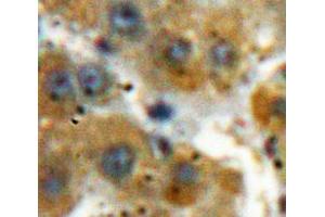 Used in DAB staining on fromalin fixed paraffin-embedded Liver tissue