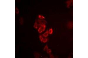 Immunofluorescent analysis of Connexin 40 staining in HepG2 cells. (Cx40/GJA5 antibody)