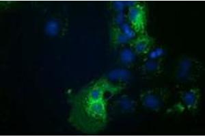 Anti-HDAC6 mouse monoclonal antibody (ABIN2454079) immunofluorescent staining of COS7 cells transiently transfected by pCMV6-ENTRY HDAC6 (RC209649). (HDAC6 antibody)