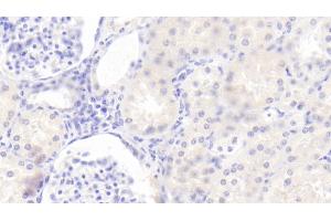 Detection of TSLP in Human Kidney Tissue using Polyclonal Antibody to Thymic Stromal Lymphopoietin (TSLP) (Thymic Stromal Lymphopoietin antibody  (AA 29-159))