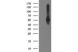 HEK293T cells were transfected with the pCMV6-ENTRY control (Left lane) or pCMV6-ENTRY DLD (Right lane) cDNA for 48 hrs and lysed. (DLD antibody)