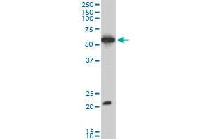 EBF3 monoclonal antibody (M06), clone 1G3. (EBF3 antibody  (AA 381-480))