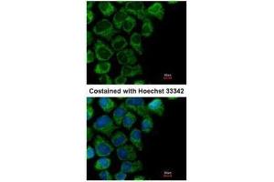 ICC/IF Image Immunofluorescence analysis of methanol-fixed A431, using OAT, antibody at 1:200 dilution. (OAT antibody)