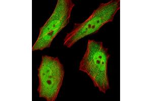 Immunofluorescence (IF) image for anti-Ring-Box 1, E3 Ubiquitin Protein Ligase (RBX1) (AA 74-108), (C-Term) antibody (ABIN1944784)