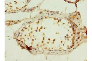 Immunohistochemistry of paraffin-embedded human testis tissue using ABIN7174888 at dilution of 1:100 (C7orf61 antibody  (AA 1-206))