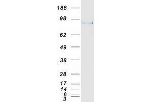 Validation with Western Blot (SOX6 Protein (Transcript Variant 2) (Myc-DYKDDDDK Tag))