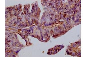 Immunohistochemistry of paraffin-embedded human adrenal gland tissue using ABIN7152940 at dilution of 1:100 (FIL1L antibody  (AA 1-200))