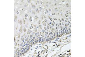 Immunohistochemistry of paraffin-embedded human esophagus using RHOT1 antibody (ABIN5973450) at dilution of 1/100 (40x lens). (RHOT1 antibody)