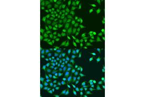 Immunofluorescence analysis of U2OS cells using RUVBL1/TIP49A/PONTIN antibody (ABIN6132606, ABIN6147318, ABIN6147320 and ABIN6218477) at dilution of 1:100. (RUVBL1 antibody  (AA 1-214))