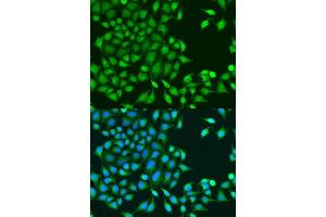 Immunofluorescence analysis of U2OS cells using RUVBL1/TIP49A/PONTIN antibody (ABIN6132606, ABIN6147318, ABIN6147320 and ABIN6218477) at dilution of 1:100. (RUVBL1 antibody  (AA 1-214))