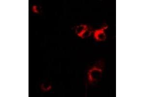 Immunofluorescent analysis of IL-1RA staining in MCF7 cells. (IL1RN antibody)