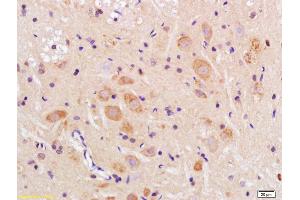 Formalin-fixed and paraffin embedded rat brain labeled with Anti-TMEM158 Polyclonal Antibody, Unconjugated (ABIN1386582) at 1:200 followed by conjugation to the secondary antibody and DAB staining