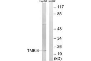 Western Blotting (WB) image for anti-Transmembrane BAX Inhibitor Motif Containing 4 (TMBIM4) (AA 121-170) antibody (ABIN2890669) (TMBIM4 antibody  (AA 121-170))