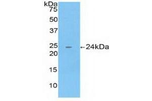 Detection of Recombinant CTSB, Human using Polyclonal Antibody to Cathepsin B (CTSB) (Cathepsin B antibody  (AA 129-333))