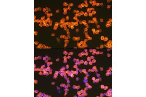 Immunofluorescence analysis of Jurkat cells using Z Rabbit mAb (ABIN7271430) at dilution of 1:100 (40x lens). (ZAP70 antibody)