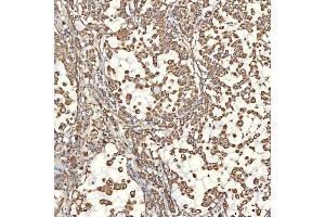 IHC analysis of TST using anti-TST antibody (ABIN7599105).
