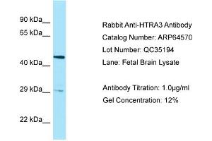 Western Blotting (WB) image for anti-HtrA Serine Peptidase 3 (HTRA3) (Middle Region) antibody (ABIN2789881) (HTRA3 antibody  (Middle Region))