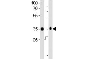 Western blot analysis of lysate from human NCCIT, mouse F9 cell line (left to right) using anti-SOX-2 antibody at 1:1000 for each lane.