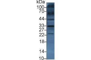 Western blot analysis of Mouse Heart lysate, using Human TKA1 Antibody (3 µg/ml) and HRP-conjugated Goat Anti-Rabbit antibody ( (SLC9A3R2 antibody  (AA 56-326))