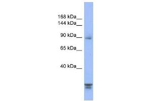 PPP2R3A antibody used at 1 ug/ml to detect target protein.
