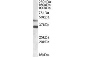Image no. 1 for anti-Arylsulfatase B (ARSB) (Internal Region) antibody (ABIN374887) (Arylsulfatase B antibody  (Internal Region))