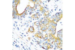 Immunohistochemistry of paraffin-embedded human stomach using MT-CO2 antibody. (COX2 antibody  (AA 100-200))