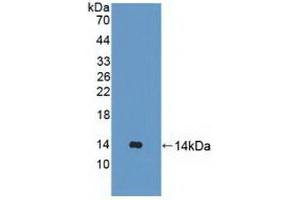 Detection of Recombinant UBQLN2, Human using Polyclonal Antibody to Ubiquilin 2 (UBQLN2) (Ubiquilin 2 antibody  (AA 33-126))