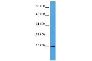 Western Blot showing DEFB4A antibody used at a concentration of 1-2 ug/ml to detect its target protein. (DEFB4A antibody  (N-Term))