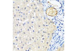 Immunohistochemistry of paraffin-embedded human liver using LRP5 antibody at dilution of 1:200 (40x lens).