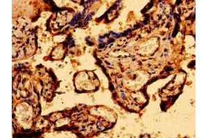 Immunohistochemistry of paraffin-embedded human placenta tissue using ABIN7146314 at dilution of 1:100 (MCU antibody  (AA 155-233))