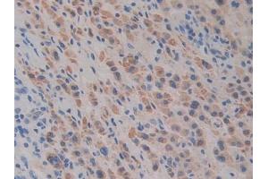 Detection of Slit1 in Human Liver Tissue using Polyclonal Antibody to Slit Homolog 1 (Slit1) (SLIT1 antibody  (AA 603-773))