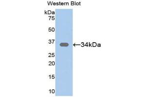 Western blot analysis of the recombinant protein. (SFRP1 antibody  (AA 32-314))