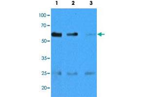 Western blot analysis of mouse muscle extracts (35 ug) with CASQ2 monoclonal antibody, clone AT4E10  at 1:500 (Lane 1), 1:1000 (Lane 2) and , 1:5000 (Lane 3) dilution. (CASQ2 antibody  (AA 20-399))