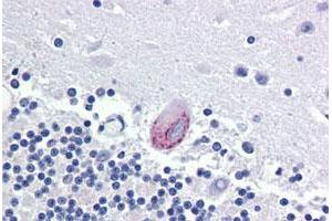Immunohistochemical staining of human brain, cerebellum with LPCAT1 polyclonal antibody . (LPCAT1 antibody  (Internal Region))