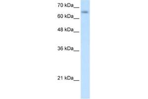 Western Blotting (WB) image for anti-Solute Carrier Family 39 (Zinc Transporter), Member 12 (SLC39A12) antibody (ABIN2462779) (SLC39A12 antibody)