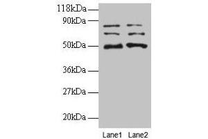 Western blot All lanes: VOPP1 antibody at 2 μg/mL Lane 1: EC109 whole cell lysate Lane 2: 293T whole cell lysate Secondary Goat polyclonal to rabbit IgG at 1/15000 dilution Predicted band size: 20, 19, 18 kDa Observed band size: 50, 70, 80 kDa