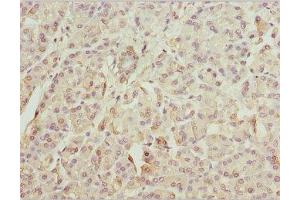 IHC analysis of paraffin-embedded human pancreatic tissue using ZFYVE1 antibody (1/100 dilution).