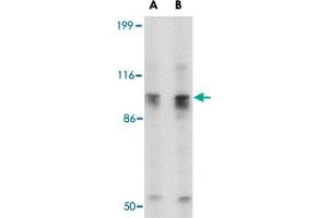 Western blot analysis of SLITRK6 in SK-N-SH cell lysate with SLITRK6 polyclonal antibody  at (A) 0. (SLITRK6 antibody  (C-Term))