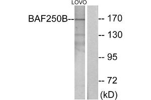 Western blot analysis of extracts from LOVO cells, using BAF250B antibody. (ARID1B antibody  (Internal Region))