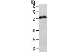 Gel: 8 % SDS-PAGE,Lysate: 40 μg,Lane: Human normal stomach tissue,Primary antibody: ABIN7192491(SLC43A2 Antibody) at dilution 1/200 dilution,Secondary antibody: Goat anti rabbit IgG at 1/8000 dilution,Exposure time: 5 minute (SLC43A2 antibody)